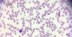 Pyriform with pair formation of Babesia caballi inside the rbcs