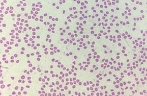 Fig. Microscopic view showing Babesia ovis in the blood